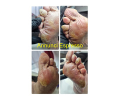 CorsoCorso Base di Podotecnica (pedicure curativo)